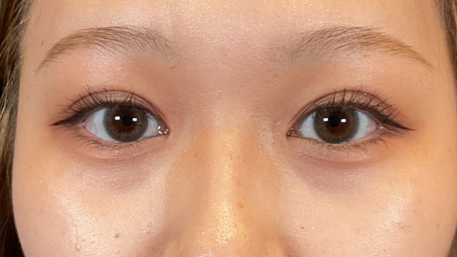 手术前的状态 其一