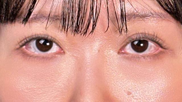 手术前的状态 其一