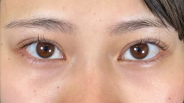 手术前的状态 其一