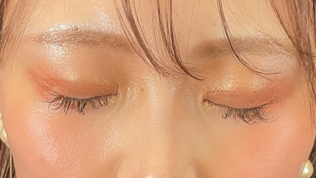 手术前的状态 其一