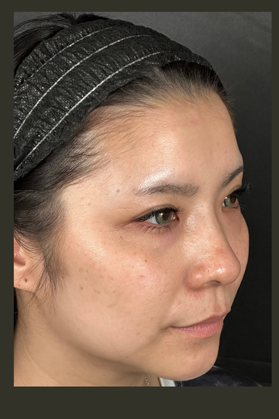 Postoperative Condition Part 1