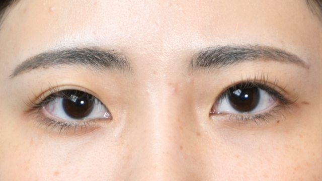 Postoperative Condition Part 1