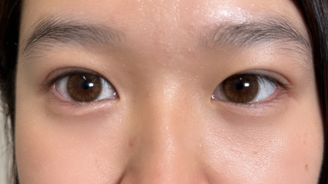 手术前的状态 其一