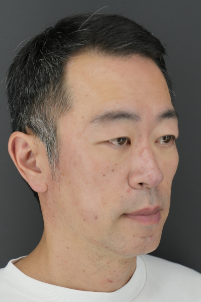 手術前の状態 その1