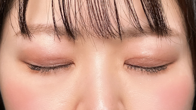 手术前的状态 其一