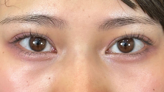 手术前的状态 其一