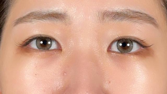 手术前的状态 其一