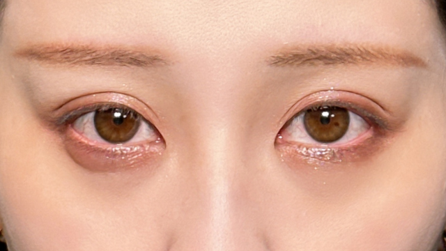 手术前的状态 其一