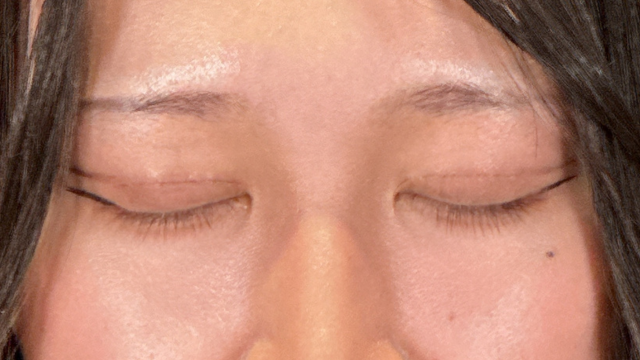 手术前的状态 其一