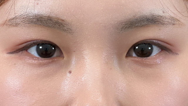 Postoperative Condition Part 1