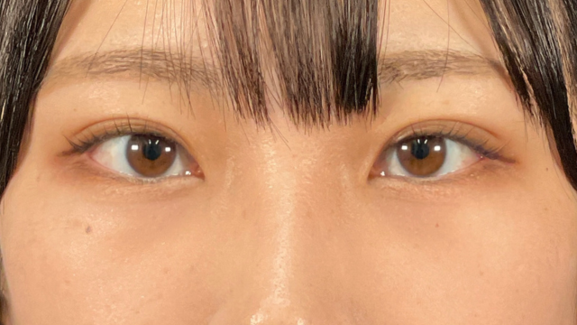 手術前の状態 その1