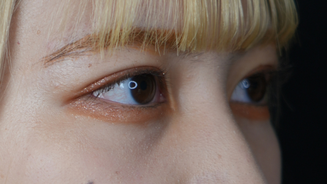 手術前の状態 その1