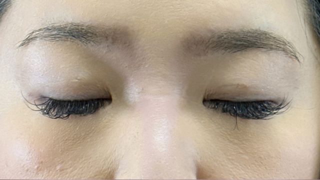 Postoperative Condition Part 1