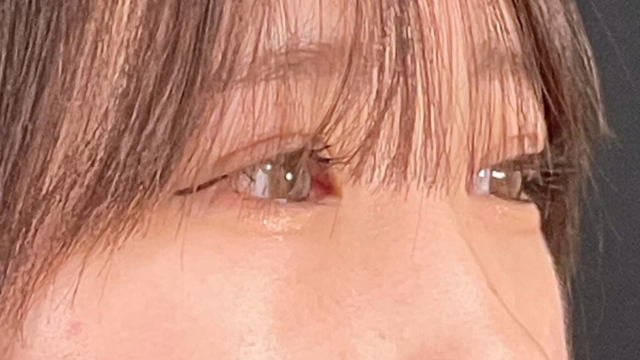 Postoperative Condition Part 1