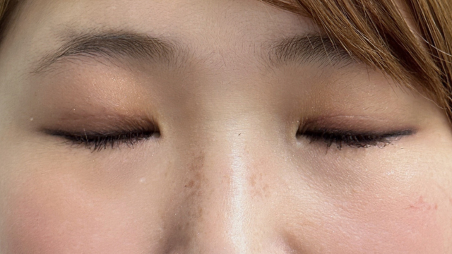 Postoperative Condition Part 1