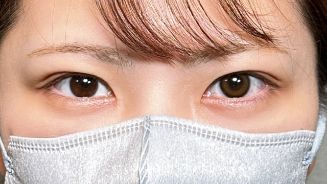 手术前的状态 其一