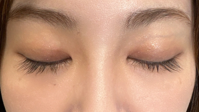 手术前的状态 其一