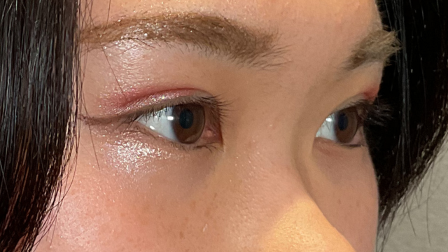 手术前的状态 其一