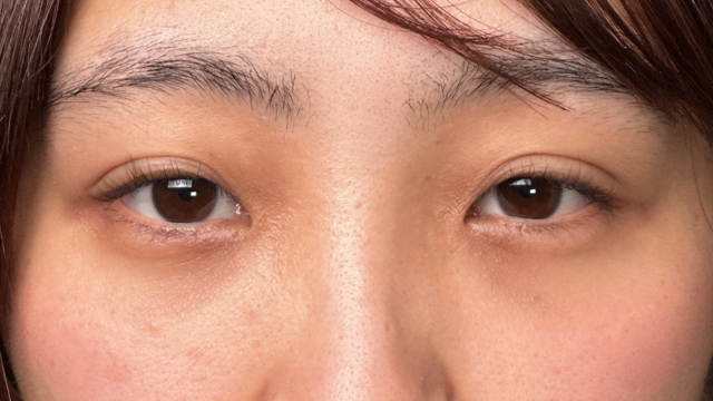 Postoperative Condition Part 1