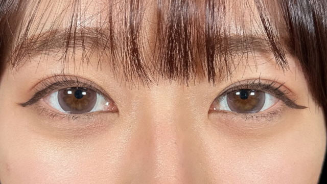 手术前的状态 其一