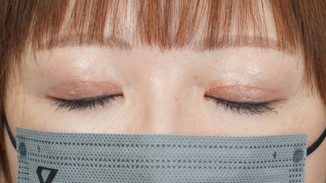 手术前的状态 其一