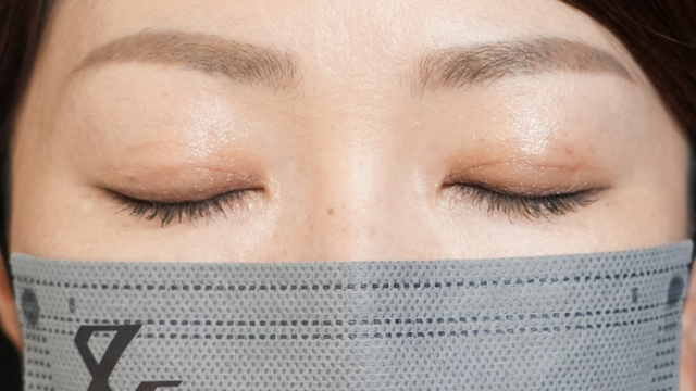 手术前的状态 其一