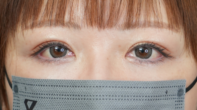 手术前的状态 其一