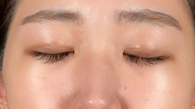 手术前的状态 其一