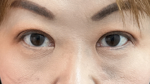 手术前的状态 其一