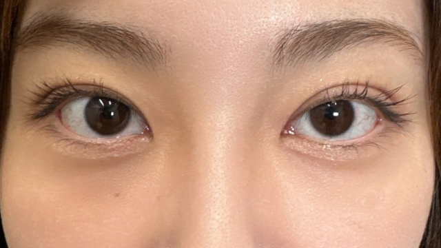 手术前的状态 其一