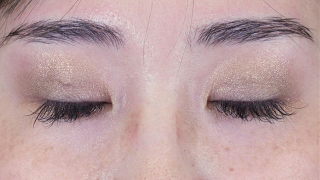 手術前の状態 その1