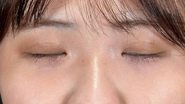 手术前的状态 其一