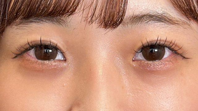 手术前的状态 其一