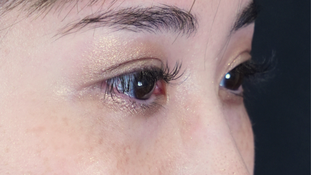 手術前の状態 その1