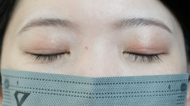 手术前的状态 其一