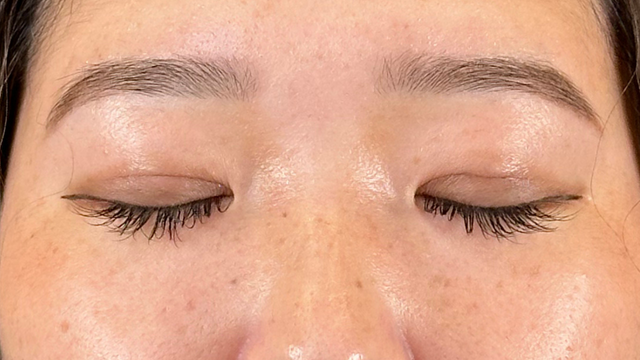 手术前的状态 其一