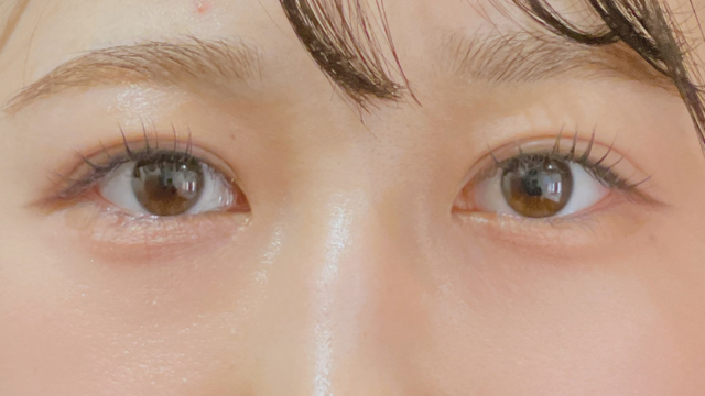 手术前的状态 其一