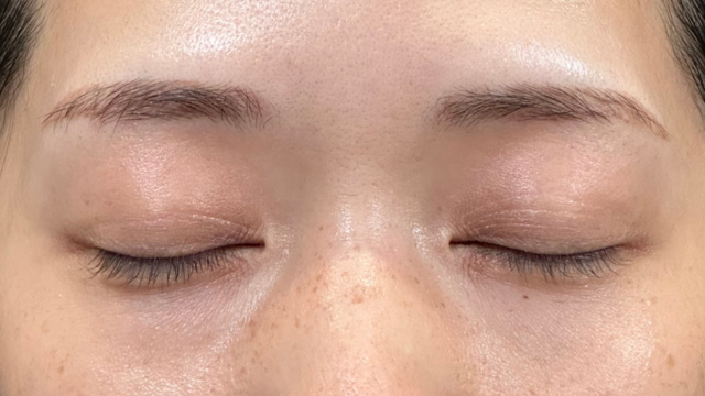 手術前の状態 その1