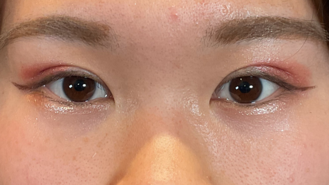 手术前的状态 其一