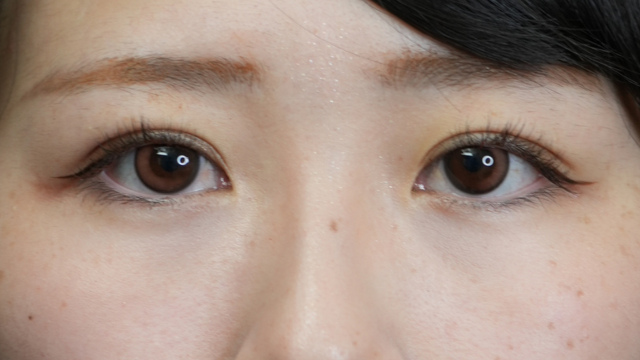 手术前的状态 其一