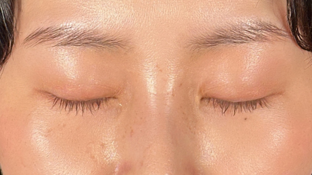 手术前的状态 其一