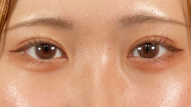 手术前的状态 其一