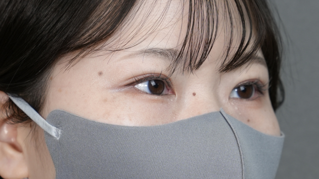 手术前的状态 其一