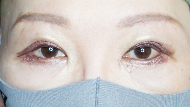 Postoperative Condition Part 1