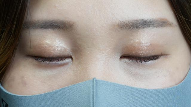 手術前の状態 その1