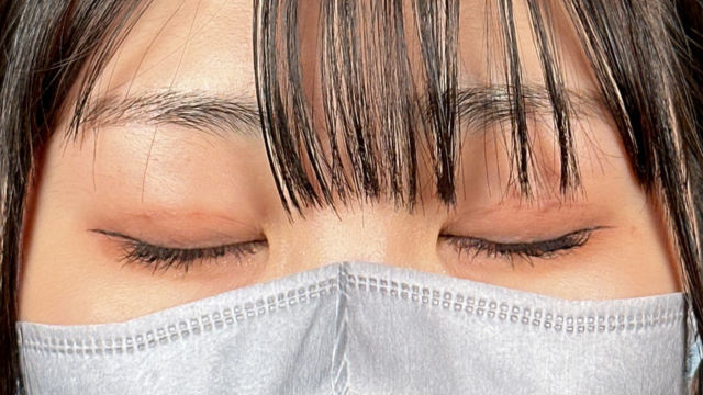 手术前的状态 其一