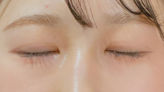 手术前的状态 其一