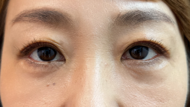 Postoperative Condition Part 1