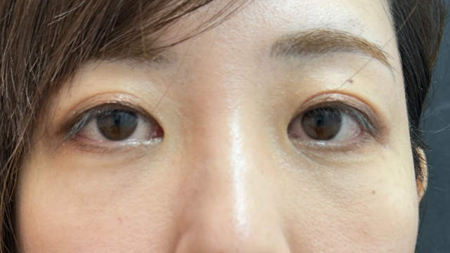 手术前的状态 其一