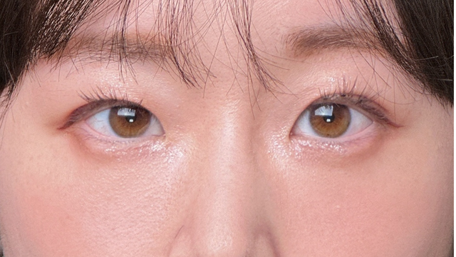 Postoperative Condition Part 1